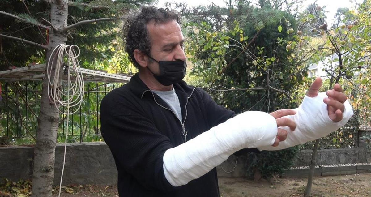 Pitbulla saldırıya uğrayan Erol Duran kolları parçalandı